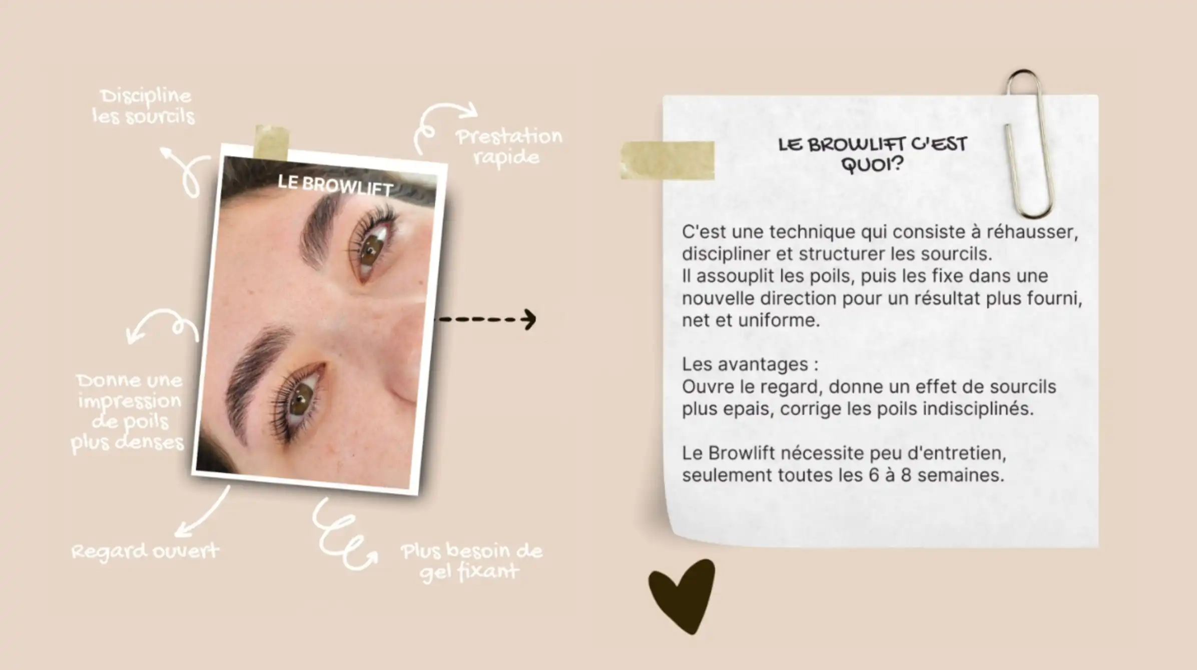 browlift
