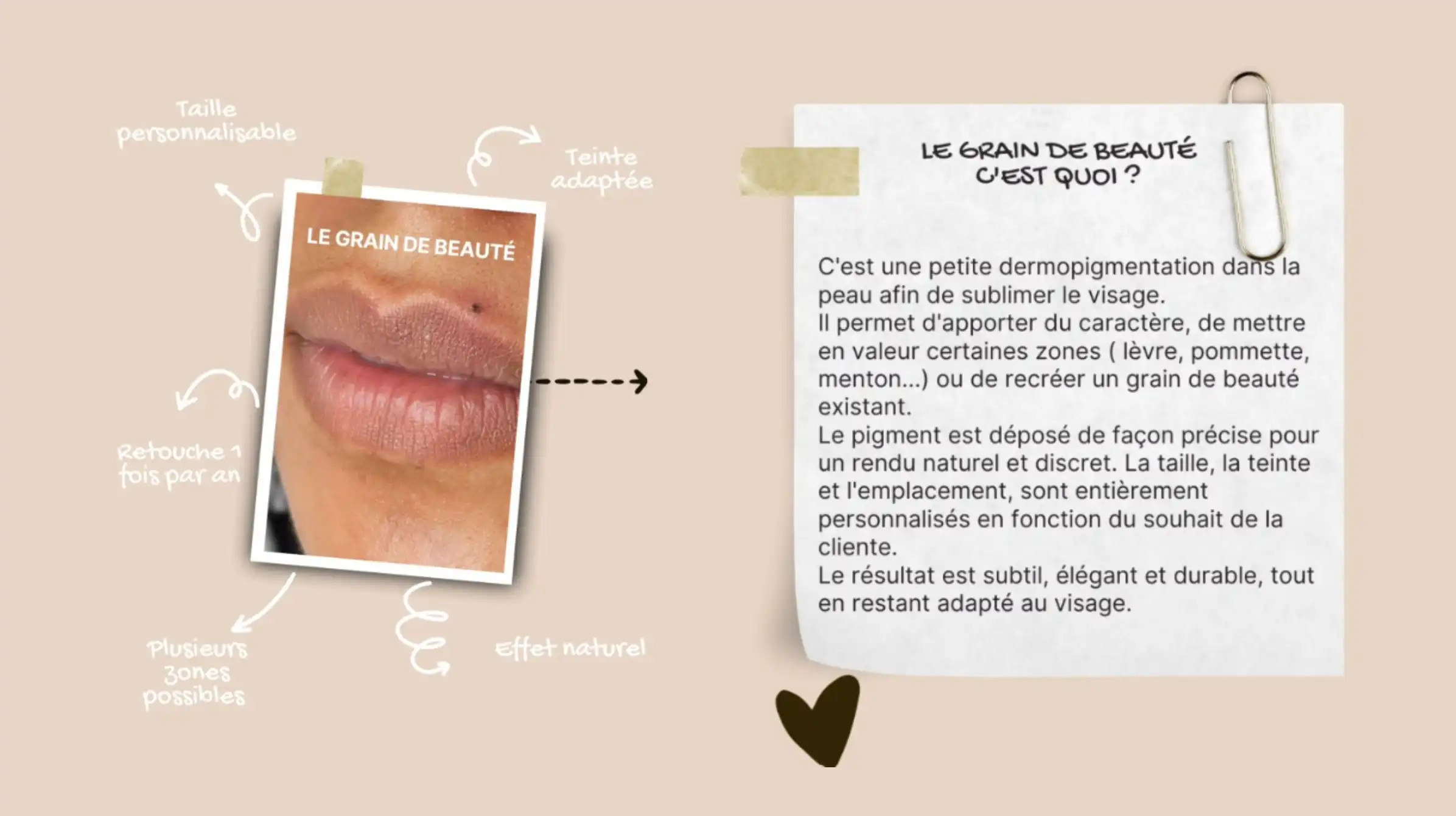 grain-de-beaute