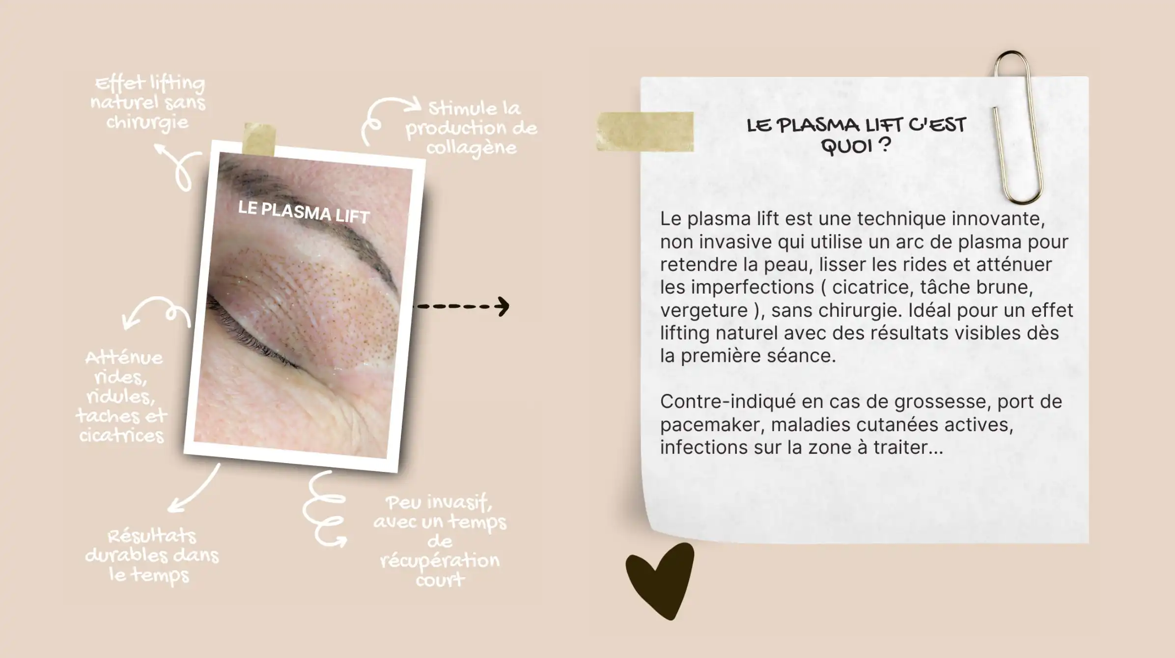 plasma-lift