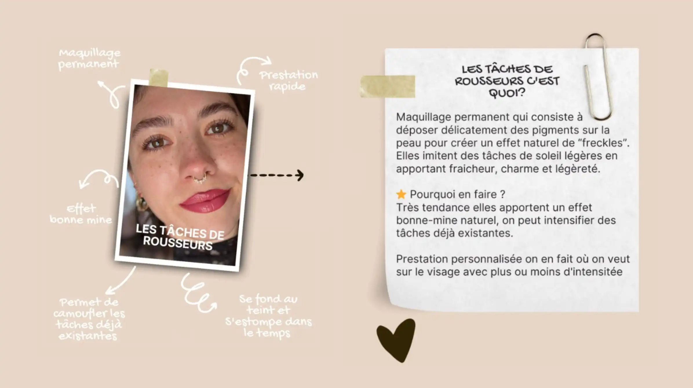 tache-de-rousseur